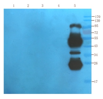 FAS Biosimilar Antibody