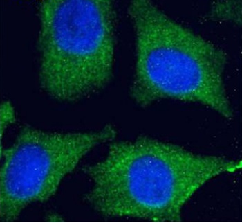 DC-SIGNR Antibody [16E7], Rabbit IgG