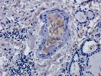 CD52 Antibody [Campath-1H], Human IgG1