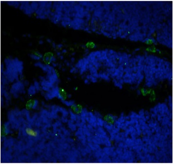 CD52 Antibody [Campath-1H], Human IgG1