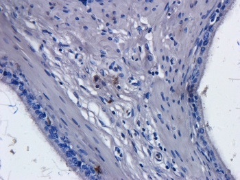 CD52 Antibody [Campath-1H], Human IgG1