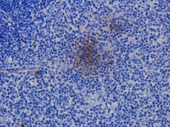 CD52 Antibody [Campath-1H], Human IgG1