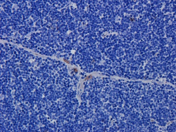 CD52 Antibody [Campath-1H], Human IgG1