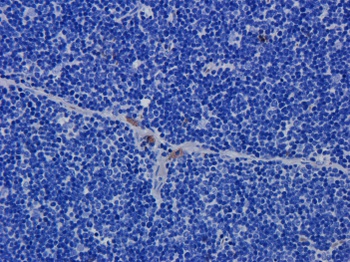 CD52 Antibody