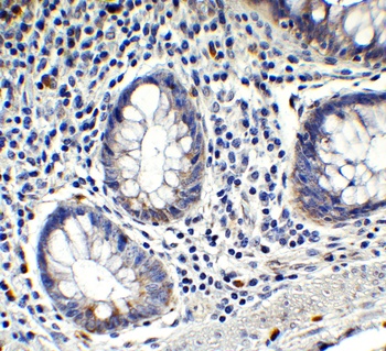 IFI16 (CT) Antibody