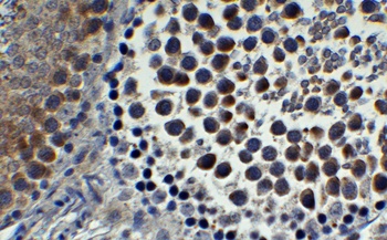 IFI16 (CT) Antibody