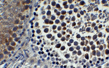 IFI16 Antibody