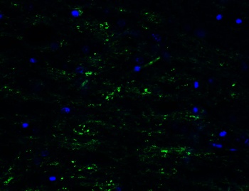 POLRMT (CT) Antibody