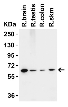 ZC3H12A (CT) Antibody