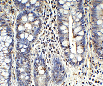 ZC3H12A (CT) Antibody