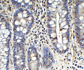 ZC3H12A Antibody