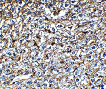 ZC3H12A (CT) Antibody