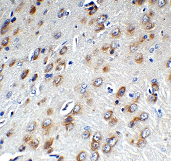 ZC3H12A (CT) Antibody