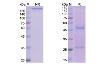 Reslizumab (IL5) - Research Grade Biosimilar