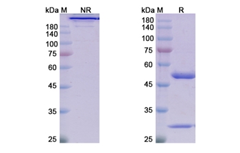 Satralizumab (IL6R) - Research Grade Biosimilar Antibody