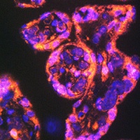 Anti-CD49e Antibody