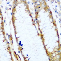 Myosin 9 Rabbit Polyclonal Antibody