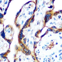 GDF15 antibody