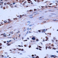 Anti-NCOA4 Antibody