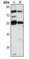 LPCAT3 Rabbit Polyclonal Antibody