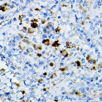 Anti-CCR3 Antibody