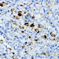 CCR3 antibody