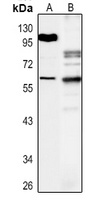RUNX2 Rabbit Polyclonal Antibody