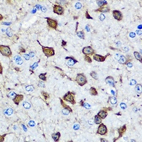 Parvalbumin alpha antibody