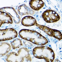 Anti-SIRT3 Antibody