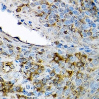 Anti-CXCL12 Antibody