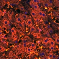 Anti-CXCL12 Antibody