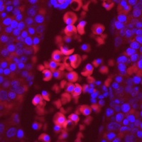 Anti-EPO Receptor Antibody