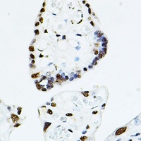 Anti-TEAD1 Antibody