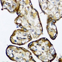 Anti-SMAD7 Antibody
