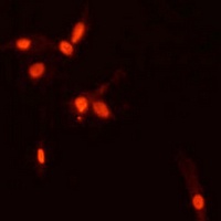 Anti-SMAD7 Antibody