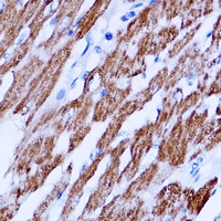 Anti-SIRT3 Antibody