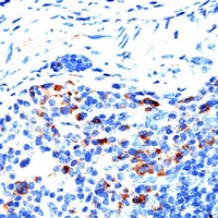 Anti-MMP9 Antibody
