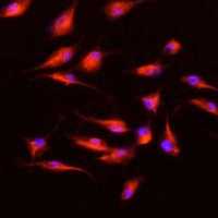 Anti-MMP9 Antibody