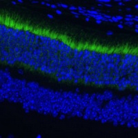 Anti-GNGT1 Antibody