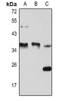 Cyclin D1 Rabbit Polyclonal Antibody