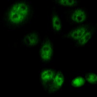 Cyclin D1 Rabbit Polyclonal Antibody