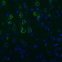 Anti-NEFM Antibody