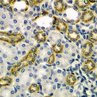 Anti-KEAP1 Antibody