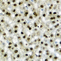Anti-SREBP-1c Antibody