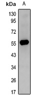 c-FOS Rabbit Polyclonal Antibody