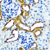 LRRK2 antibody