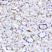 Anti-GAD1 Antibody