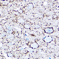 GAD1 antibody