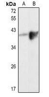 Arginase 1 Rabbit Polyclonal Antibody