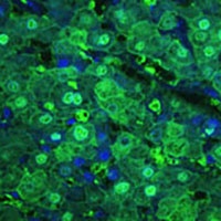 Anti-Arginase 1 Antibody